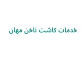 خدمات کاشت ناخن مهان